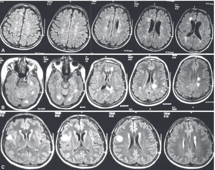 Fig. 1. Magnetic resonance imaging scans of McDonald 2010 true-positive (A), false-positive (B), and false-negative (C) patients.
