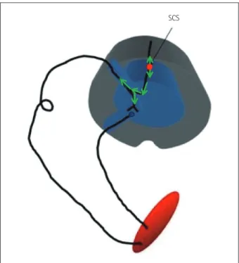 Fig. 1. Graphical representation of the activated pathway during the  antidromic CMAP technique