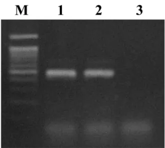 Fig. 5.  Reverse transcriptase-polymerase chain reaction products of bovine respiratory syncytial virus from lung.