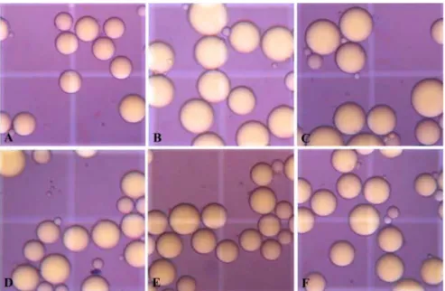 Fig. 6.  Light micrograpy of white adipocytes in obesity rat induced by high fat diet and effect of onion juice on adipocyte size