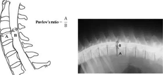 Fig. 2.  Transverse CT scan image demonstrating ROI tracing used to calculate areas for the spinal cord (SC), vertebral canal (VC) and vertebral body (VB).