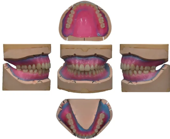Fig. 6. Definitive denture tooth setup.