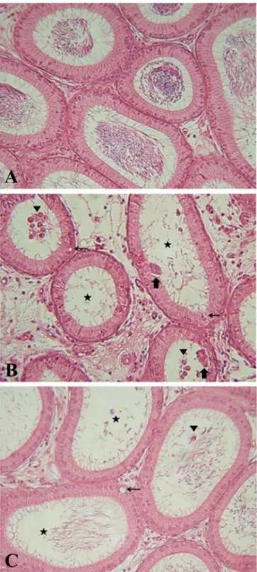 Fig. 1.  (A) Control rat caput epididymis. The epithelium and luminal contents look normal