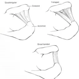 Fig. 10. Anatomical variations of CA  ligament.