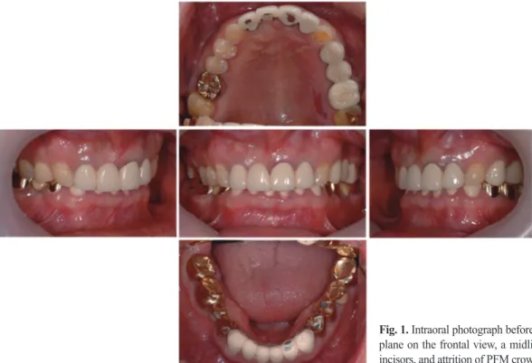 Fig. 2. Panoramic radiograph before the treatment.