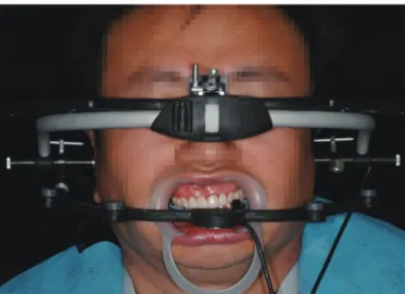 Fig. 7. Facial photograph with ARCUS Digma.