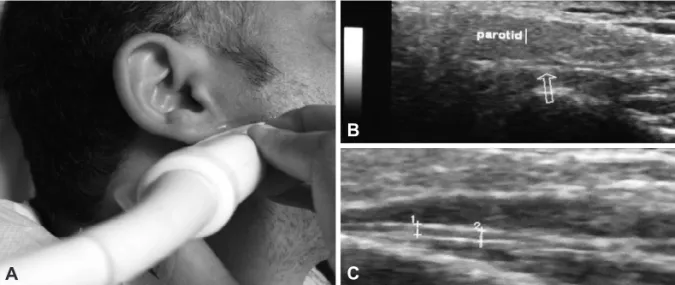 Fig. 2. A: Facial nerve scanning technique. The subject is in lateral decubitus position with the head resting on a pillow