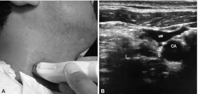 Fig. 3. A: Vagus nerve scanning technique. The subject in lateral decubitus position with head slightly extended