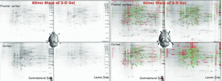 Fig. 2. Silver staining of 2-D gels of cerebrocortical tissue in different regions, revealing some different protein expression patterns.