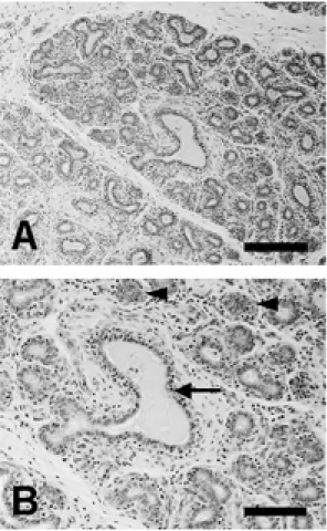 Fig. 1.  Histological findings of a Holstein cow mammary glands (A and B). There are gland lobules with alveoli (B, arrowheads) and large irregular intralobular duct (B, arrow).