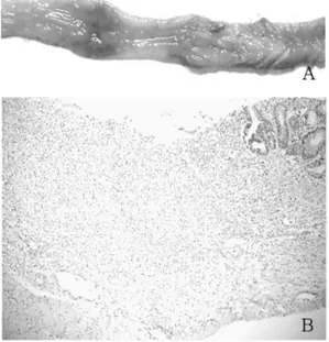 Fig. 3.  Gross (A) and microscopic (B) findings of rat colitis induced by TNBS with HemoHIM oral administration