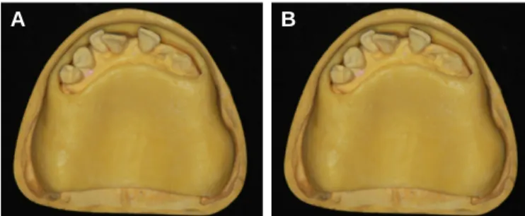 Fig. 1. Oral and radiographic examination at first visit. (A) Panoramic view, (B) Occlusal view of maxillary dentition, (C) Occlusal view of mandibular dentition.
