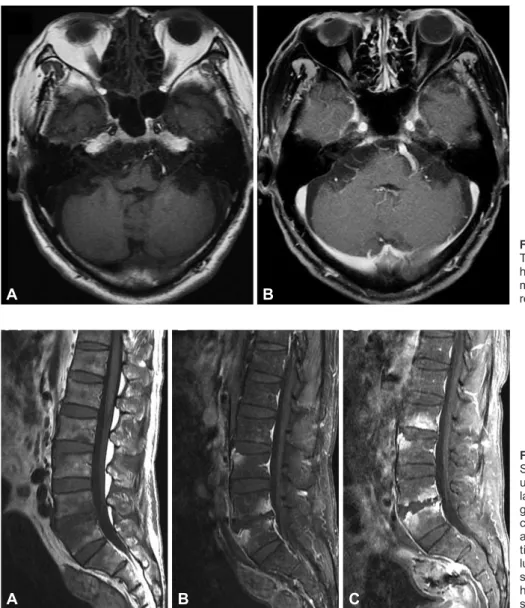 Fig. 2. Lumbar spine MRI of the patient. 