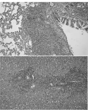 Fig. 4.  Neoplastic tumor cells express positive reaction for CD3 in the pancreas. 