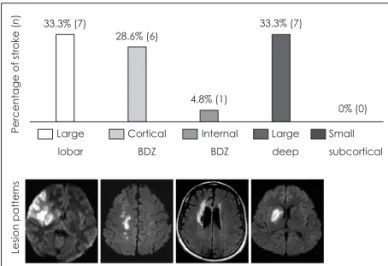 Fig. 1. Comparison of stroke patterns in Takayasu’s arteritis. BDZ: 