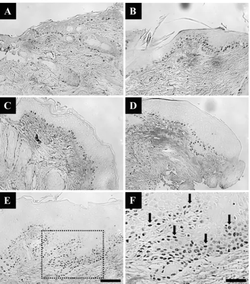 Fig. 6.  Proliferating cell nuclear antigen (PCNA) immunoreactive cells on the postoperative 7 day