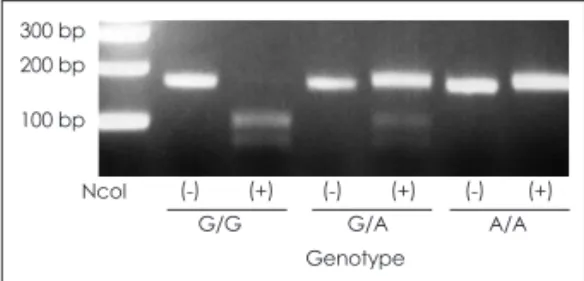 Fig. 1. Genotyping of the TNF-β gene G252A polymorphism. PCR  products were digested with Nco I under optimized conditions