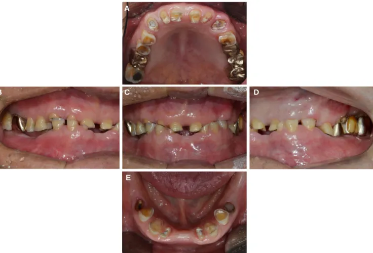 Fig. 1. Preoperative extraoral view.