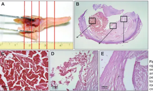 Fig. 1. Gross and histological morphol- morphol-ogy of a carotid specimen. A: Transverse  sections were taken at 5-mm intervals  and divided into central, shoulder, and  peripheral regions