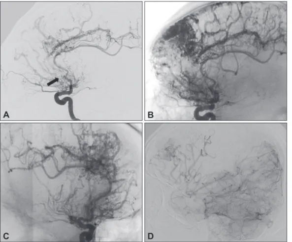 Fig. 2. Digital subtraction angiography. 