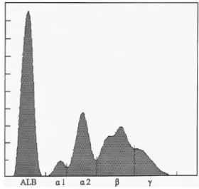 Fig. 2.  An electrophoretogram from a dog with protein- protein-losing nephropathy (PLN)