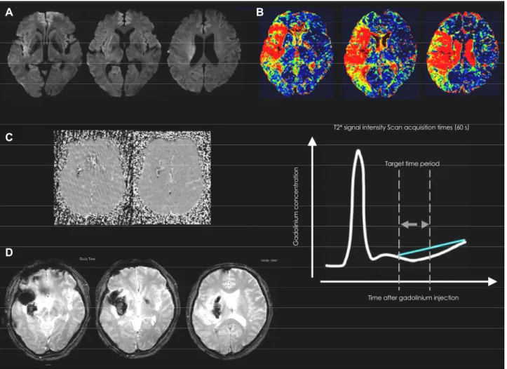 Fig. 4 shows a case with HT, and demonstrates the rela- rela-tionship between the severity of tissue damage and the  devel-opment of subsequent HT