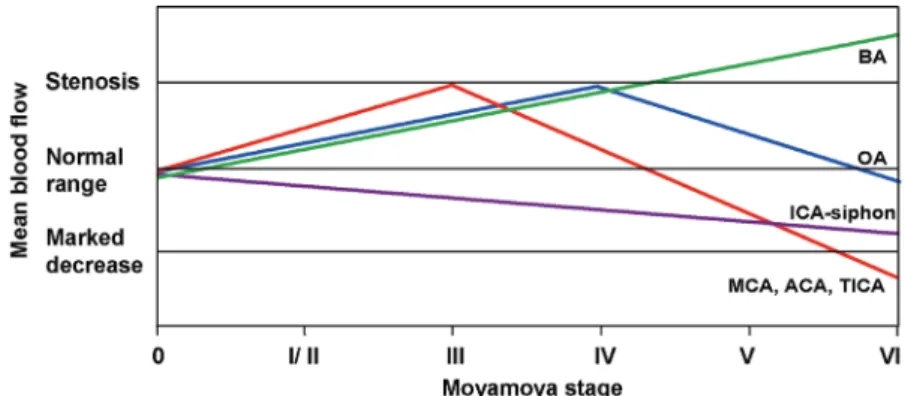 Figure 4. Combined non linear and linear hemodynamic changes in the intracranial circulation during moyamoya disease  progression