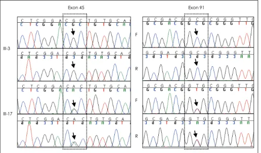 Fig. 2. DNA sequencing of the regions  of the ryanodine receptor type 1 (RYR1) gene in which the 7304CGC>CAC  (Arg 2435His) missense mutation in exon 45  and 12891GCG>GTG (Ala4295Val)  mis-sense mutation in exon 91 were  detec-ted