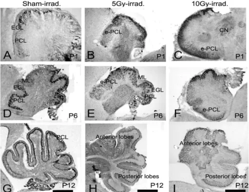 Fig. 4. Cells and lobulation of the 1st, the 6th and the 12th postnatal mouse cerebellum irradiated with r-ray at the 19th embryo