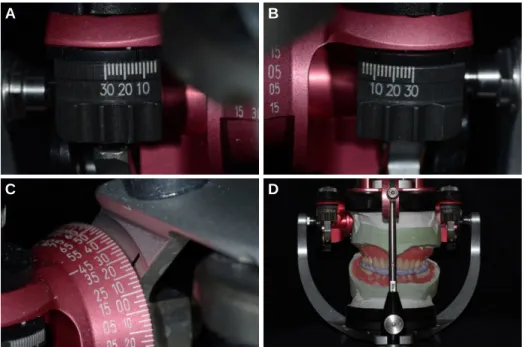 Fig. 10. Treatment dentures mounted in the articulator. (A, B) Adjustment of horizontal condylar path, (C) Adjustment of sagittal condylar path, (D) Mounting on an articulator.