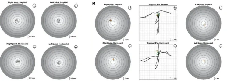 Fig. 16. Evaluation with ARCUS � digma II. (A) EPA test. ① indicates MICP. Others indicates stable centric relation