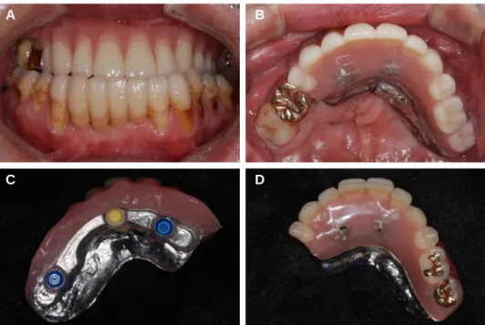 Fig. 8. 6 months follow up: occlusal view.