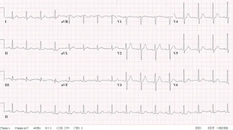 Fig. 2. Flowchart during general anesthesia and percutaneous coronary  intervention. EM = emergency medicine; ER = emergency room; OP = operation; PCI = percutaneous coronary intervention; RCA = right coronary artery; ROSC = return of spontaneous circulati