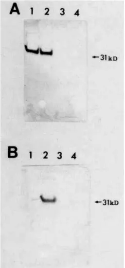 Fig. 1A  ~X  UV ï galectin-3 9[f primer  Q, RT-PCR \R&amp;. ~ UV (lane 1)