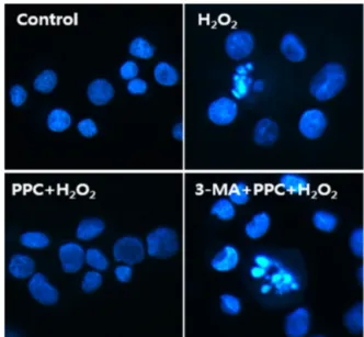 Fig. 3. Cell viability comparison. The H 2 O 2  and 3-MA/PPC/H 2 O 2  groups  had lower cell viabilities than the control group.