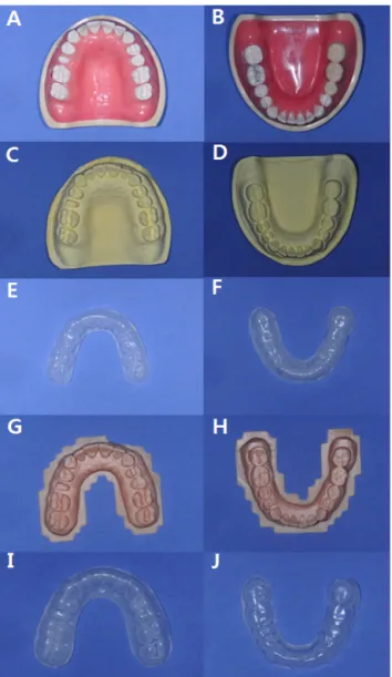 Fig. 3. PSPAs on the original dentiforms made using the conventional  method (A) and with the digital technology (B)