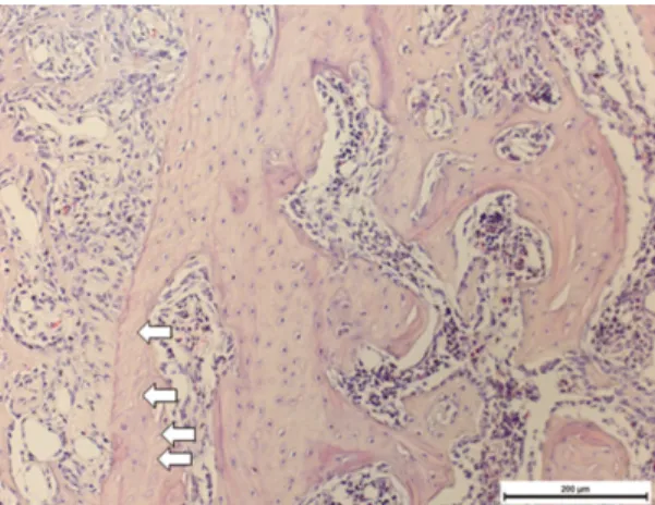 Fig. 6. TRAP positive cell counting (Right: TRAP, ×200): White arrows indicate TRAP positive cells.