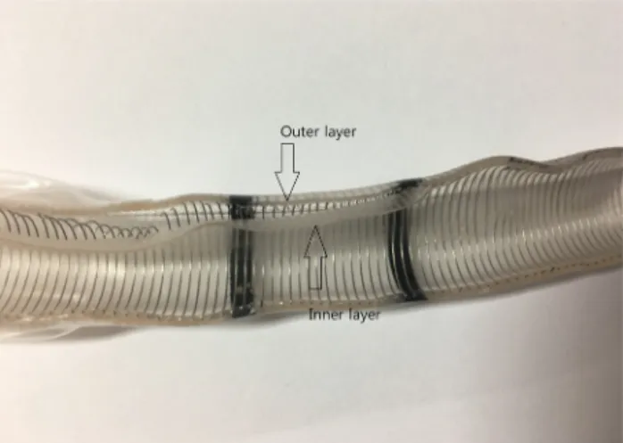 Fig. 3. Cut image of the dissected tube. The inner layer was detached from the outer layer and coil.