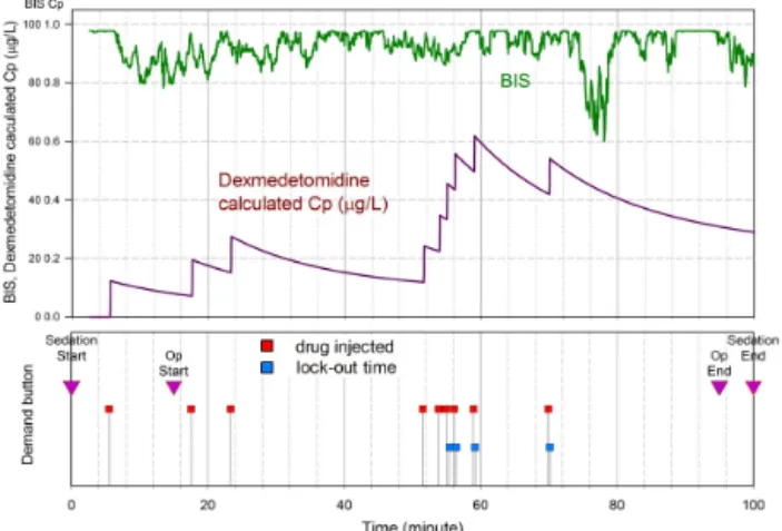 Fig. 3. Bispectral index and calculated plasma concentrations of dexmede- dexmede-tomidine [20]