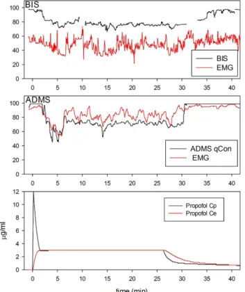 Fig. 3. Changes in BIS and ADMS qCon values under propofol 3 μg/ml target controlled infusion.
