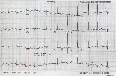 Fig. 1. Preoperative electrocardiogram. The corrected QT interval was 550 msec, significantly higher than the normal value in males (below 430 msec).