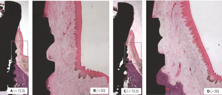Fig. 8. Soft tissue detachment observed in Bevel group only. In Bioseal group, all specimens had tight soft tissue attachment