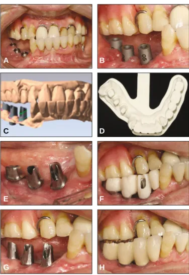 Fig. 4. Clinical pictures on case 4.