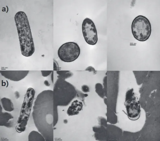 Figure  5.  Transmission  electron  photomicrograph  of  untreated  (a)  and  propolis  treated  (b)  Streptococcus  mutans  KCTC  3065