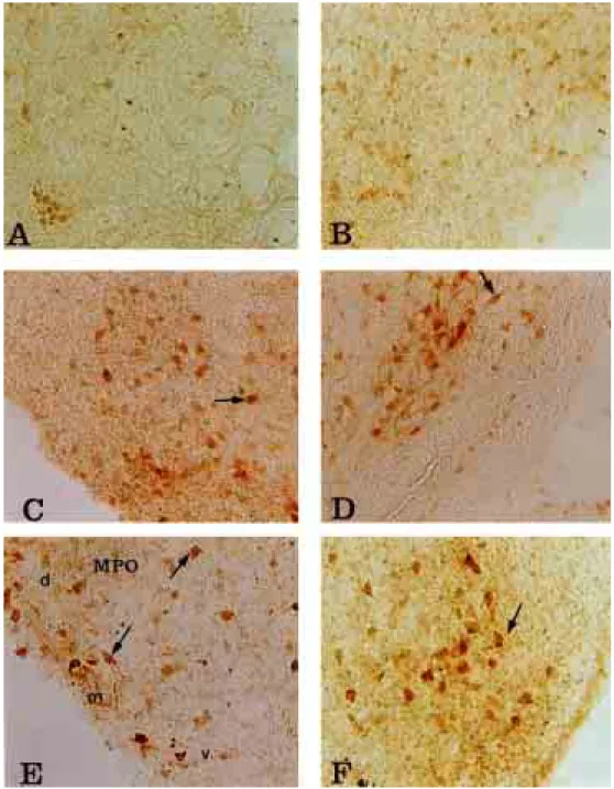 Fig. 4-A. NPY-IR neurons in nucleus preopticus medialis(POM) at E12 day of chick (×200) Fig