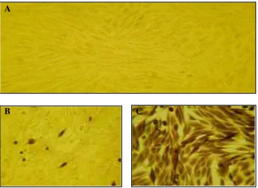 Fig. 4. Immunocytochemistry of HIV-1 gp140 protein expressed in BHK-21 cells (C and D) and COS-1 cells (A and B) infected with the pSFV-gp140 recombinant virus particles (A and C: control, B and D: infected).