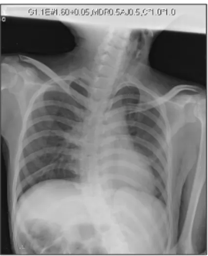 Fig.  1.  Involuntary  movement  due  to  motor  disorder  was  seen.