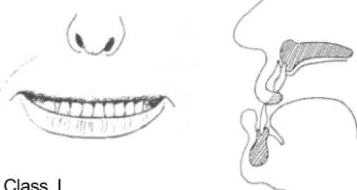 Fig.  3.  Schematic  frontal  and  lateral  view  of  upper  lip  bite  test. 