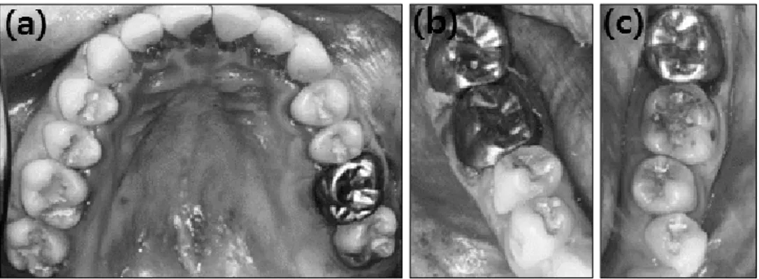 Fig.  3.  (a)  술 후 환자의  구강내  사진(상악)  (b,c)  술  후  환자의 구강내  사진(하악). 치과  치료의  전체적인  치료계획과  발생  가능한  합 병증  및  후유증에  대하여  설명하고  보호자로부터  마취동의서를  받았다