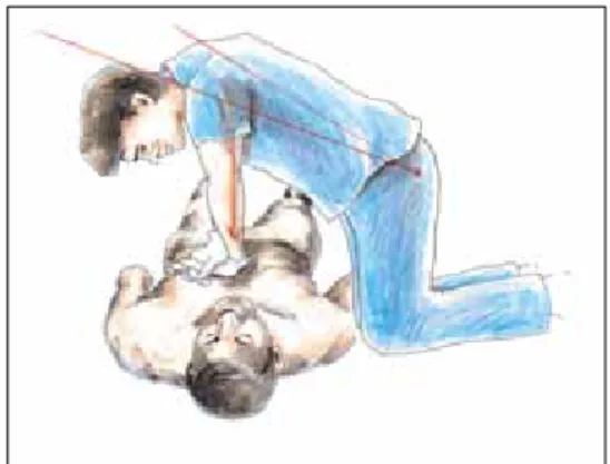 Fig.  8.  Positioning  the  rescuer’s  hands  on  the  lower  half  of  the  sternum.